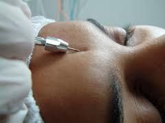 REVITALIZAÇÃO COM ELETROLIFT